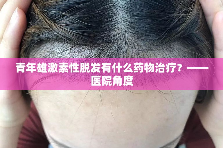 青年雄激素性脱发有什么药物治疗？——医院角度