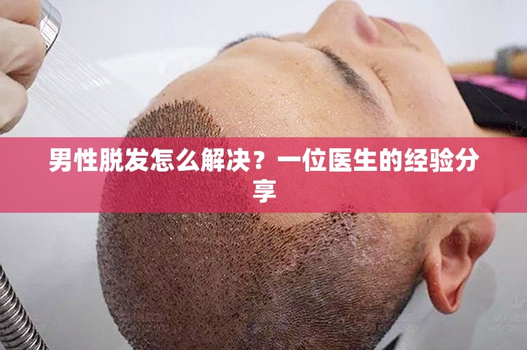 男性脱发怎么解决？一位医生的经验分享