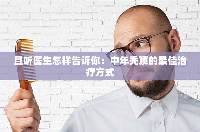 且听医生怎样告诉你：中年秃顶的最佳治疗方式