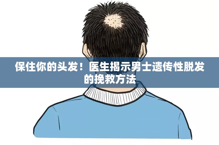 保住你的头发！医生揭示男士遗传性脱发的挽救方法