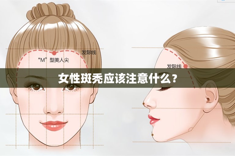 女性斑秃应该注意什么？