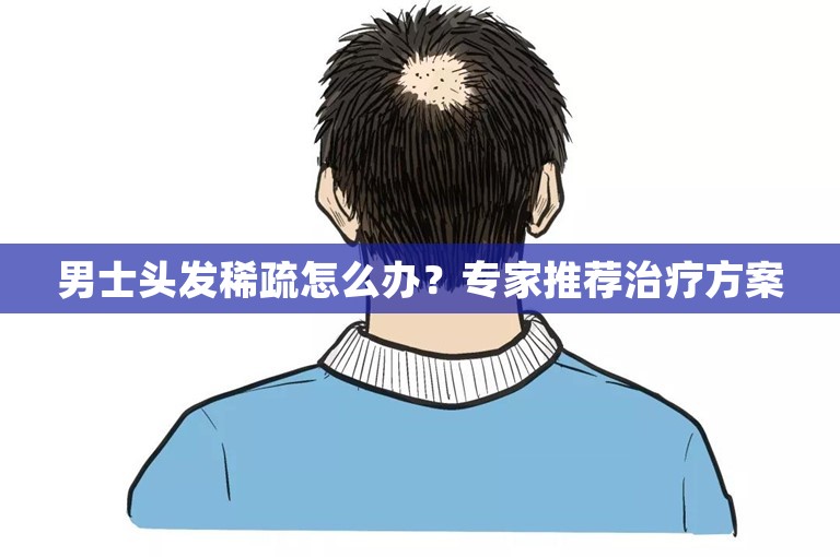 男士头发稀疏怎么办？专家推荐治疗方案