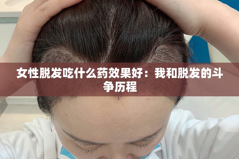 女性脱发吃什么药效果好：我和脱发的斗争历程