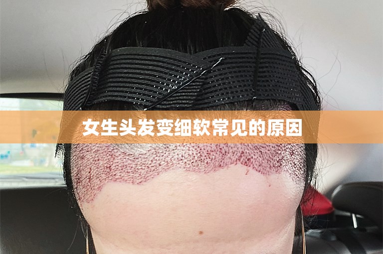 女生头发变细软常见的原因