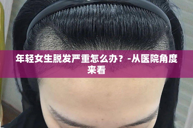 年轻女生脱发严重怎么办？-从医院角度来看