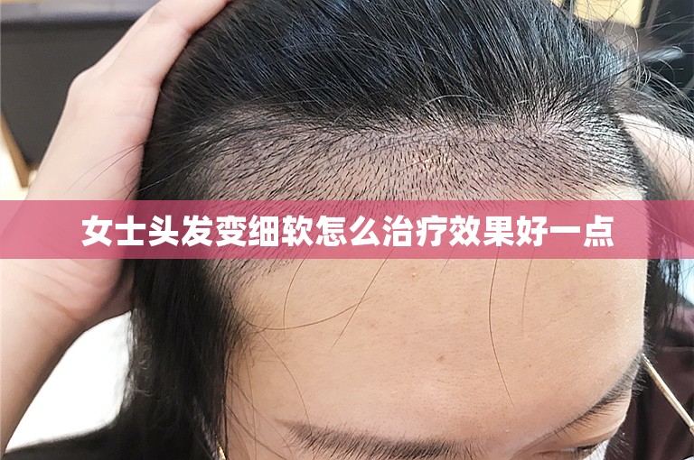 女士头发变细软怎么治疗效果好一点