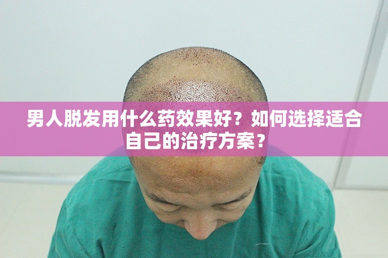 男人脱发用什么药效果好？如何选择适合自己的治疗方案？