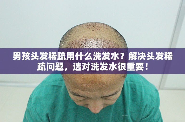 男孩头发稀疏用什么洗发水？解决头发稀疏问题，选对洗发水很重要！