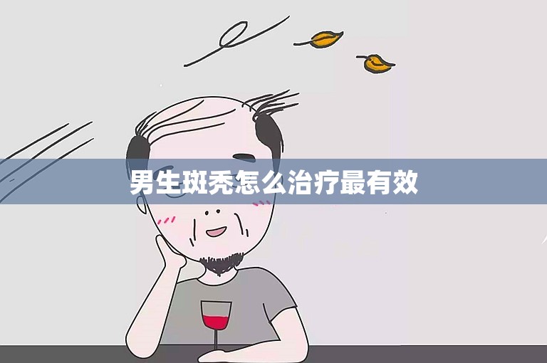 男生斑秃怎么治疗最有效