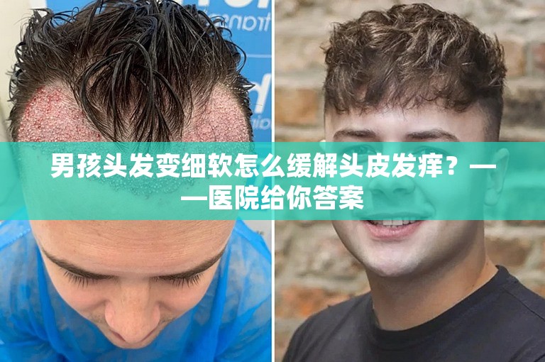 男孩头发变细软怎么缓解头皮发痒？——医院给你答案