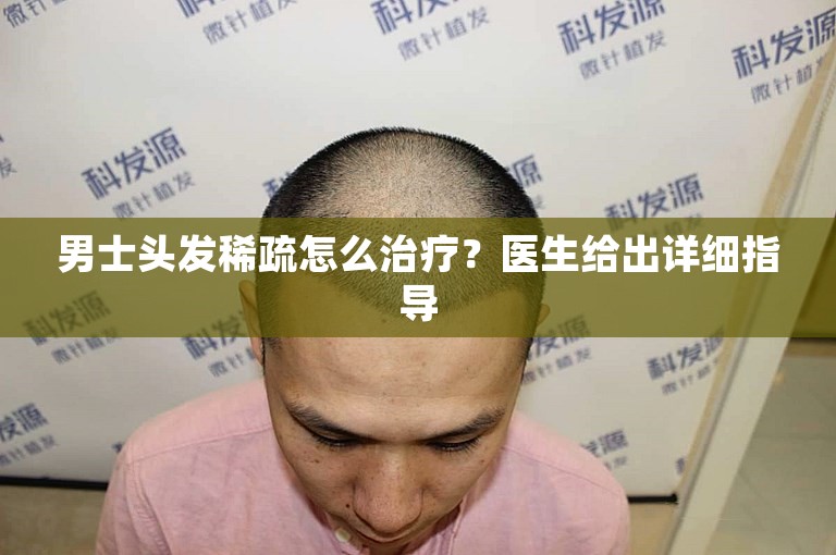 男士头发稀疏怎么治疗？医生给出详细指导