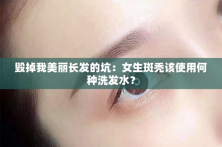 毁掉我美丽长发的坑：女生斑秃该使用何种洗发水？