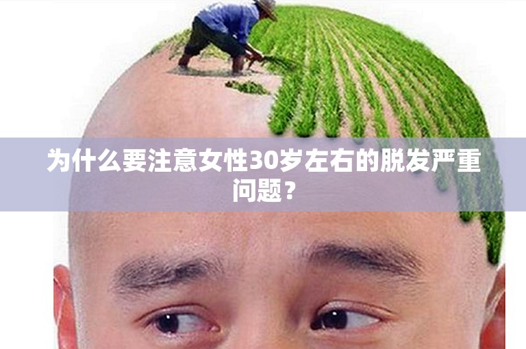 为什么要注意女性30岁左右的脱发严重问题？