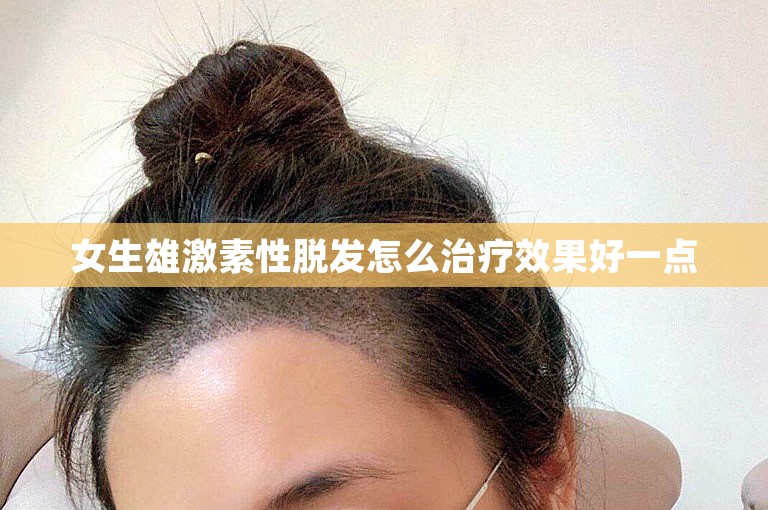 女生雄激素性脱发怎么治疗效果好一点