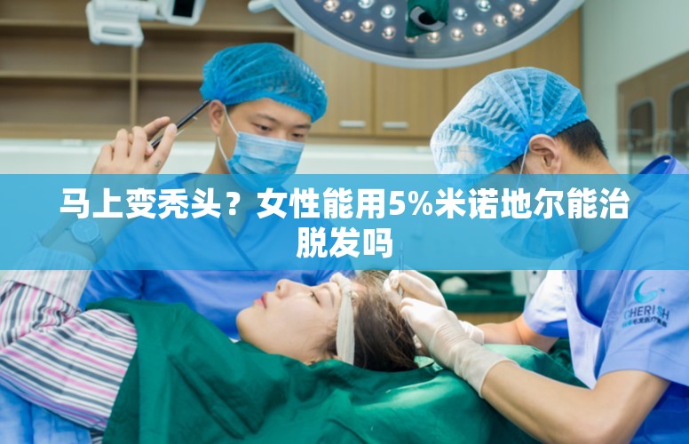 马上变秃头？女性能用5%米诺地尔能治脱发吗