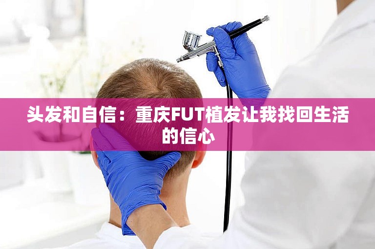 头发和自信：重庆FUT植发让我找回生活的信心