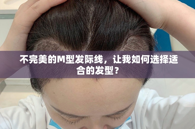  不完美的M型发际线，让我如何选择适合的发型？