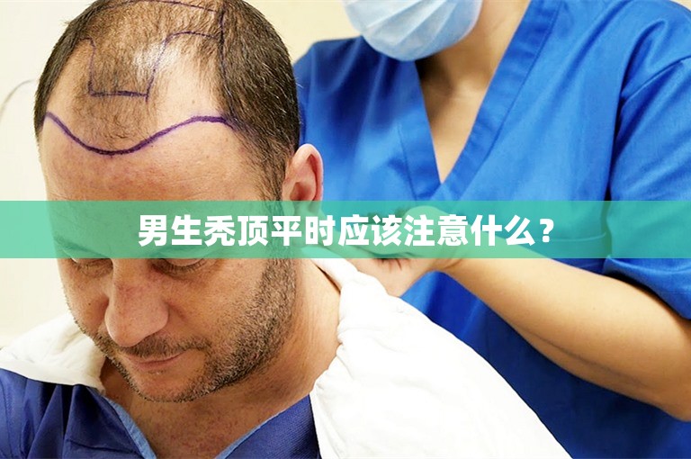 男生秃顶平时应该注意什么？