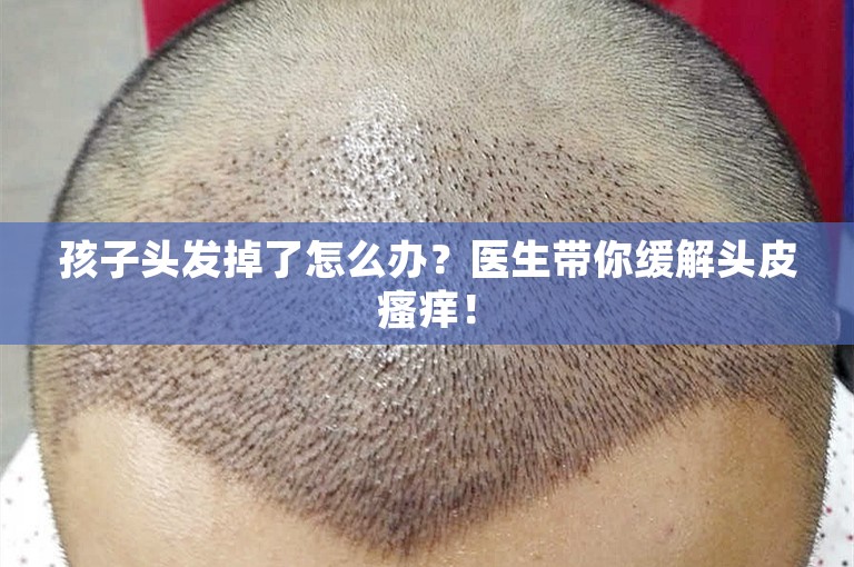 孩子头发掉了怎么办？医生带你缓解头皮瘙痒！