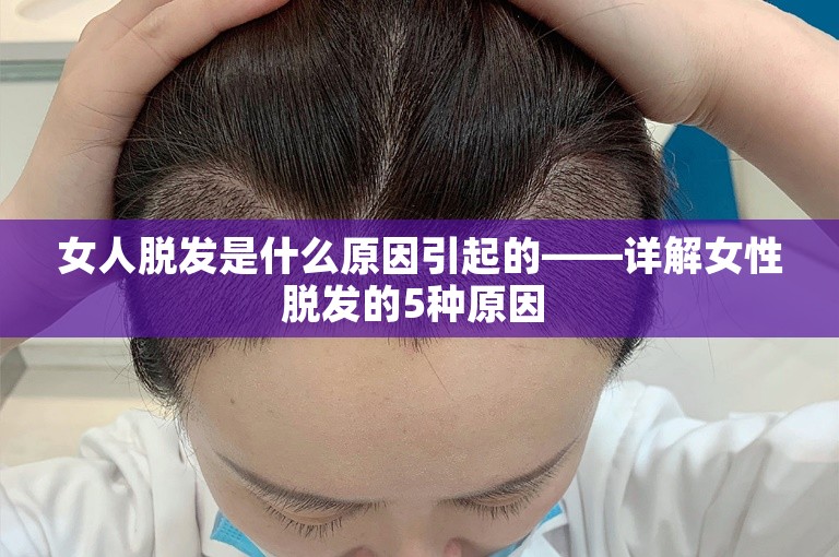 女人脱发是什么原因引起的——详解女性脱发的5种原因 