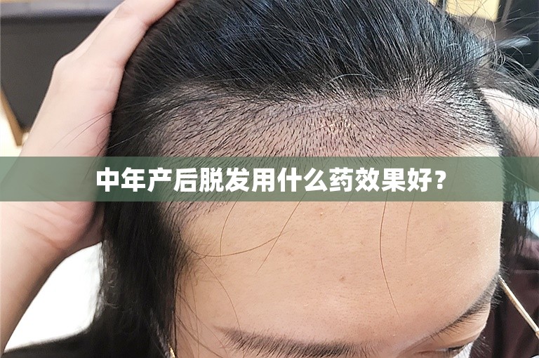 中年产后脱发用什么药效果好？