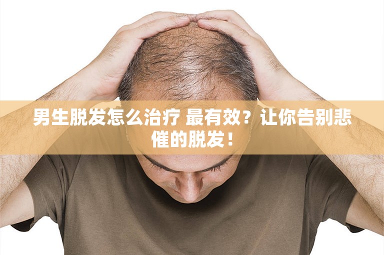 男生脱发怎么治疗 最有效？让你告别悲催的脱发！