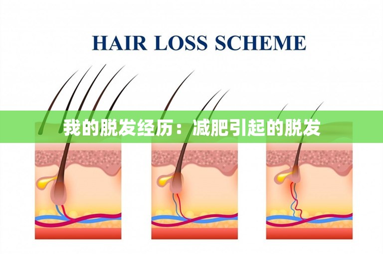 我的脱发经历：减肥引起的脱发