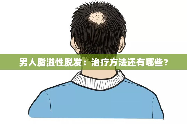 男人脂溢性脱发：治疗方法还有哪些？