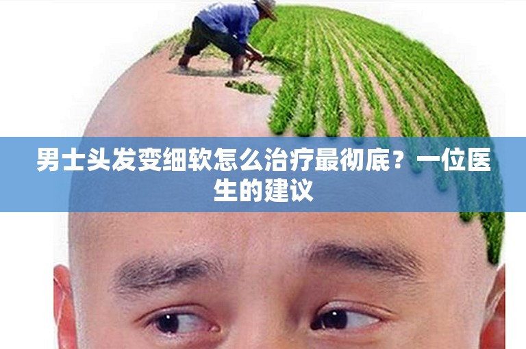 男士头发变细软怎么治疗最彻底？一位医生的建议