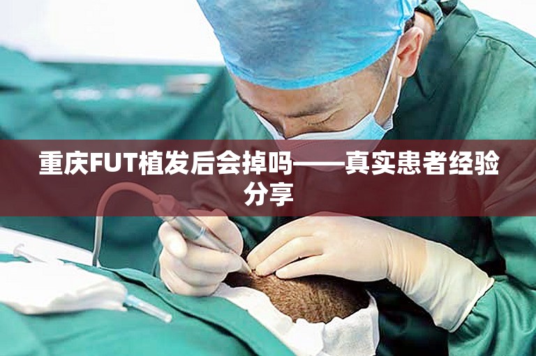 重庆FUT植发后会掉吗——真实患者经验分享