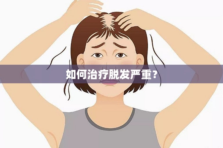 如何治疗脱发严重？