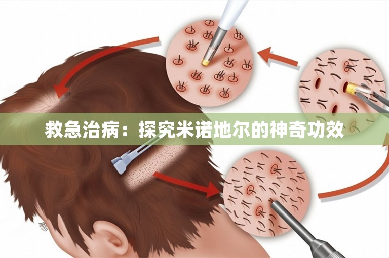 救急治病：探究米诺地尔的神奇功效