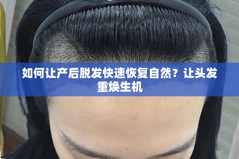 如何让产后脱发快速恢复自然？让头发重焕生机