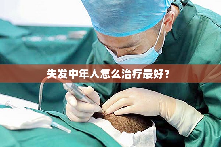  失发中年人怎么治疗最好？ 