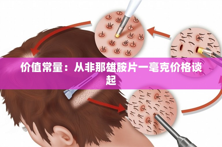 价值常量：从非那雄胺片一毫克价格谈起