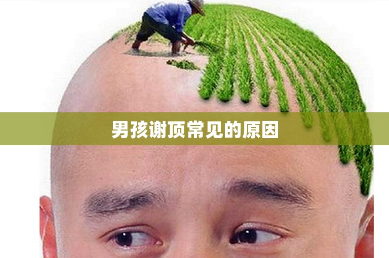 男孩谢顶常见的原因