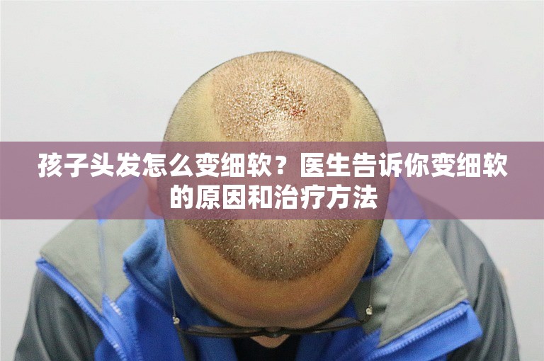 孩子头发怎么变细软？医生告诉你变细软的原因和治疗方法