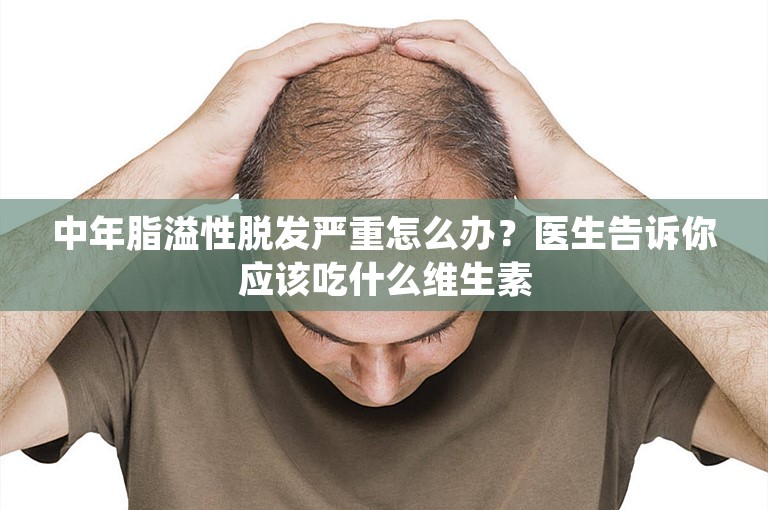 中年脂溢性脱发严重怎么办？医生告诉你应该吃什么维生素