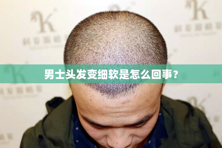 男士头发变细软是怎么回事？