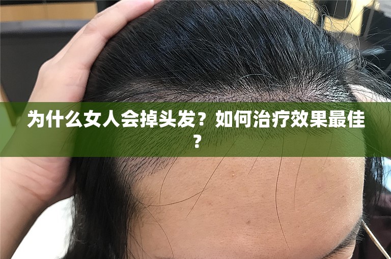 为什么女人会掉头发？如何治疗效果最佳？