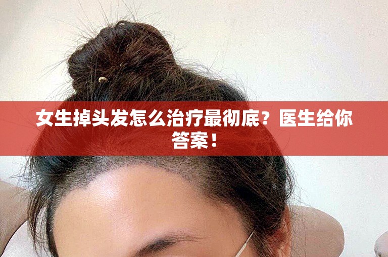 女生掉头发怎么治疗最彻底？医生给你答案！