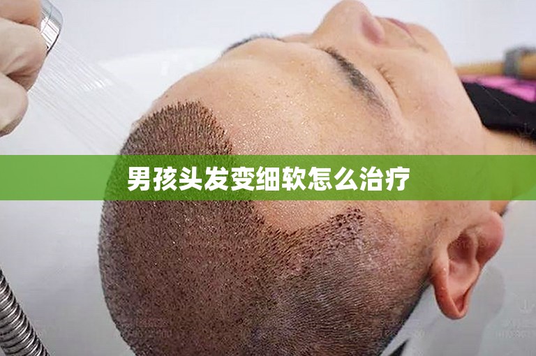 男孩头发变细软怎么治疗