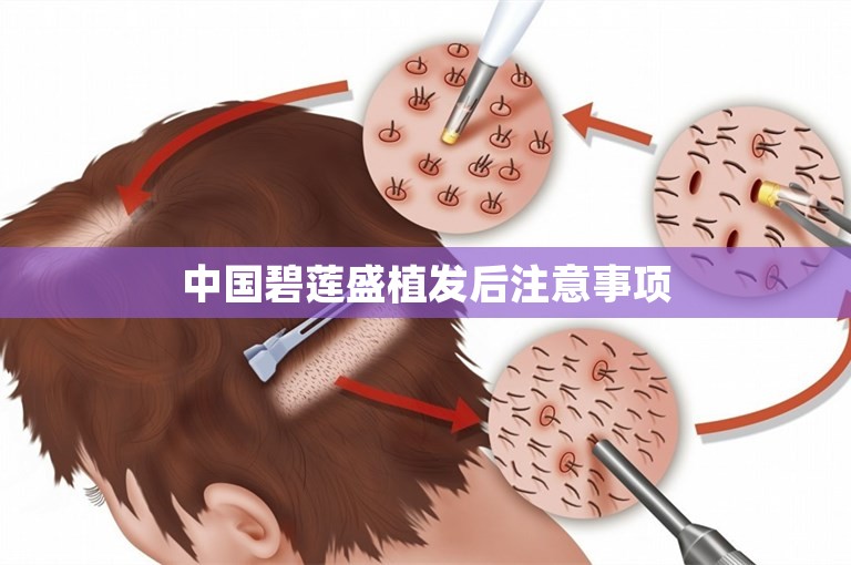 中国碧莲盛植发后注意事项