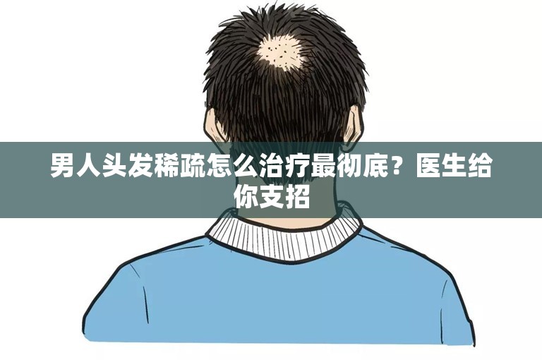 男人头发稀疏怎么治疗最彻底？医生给你支招