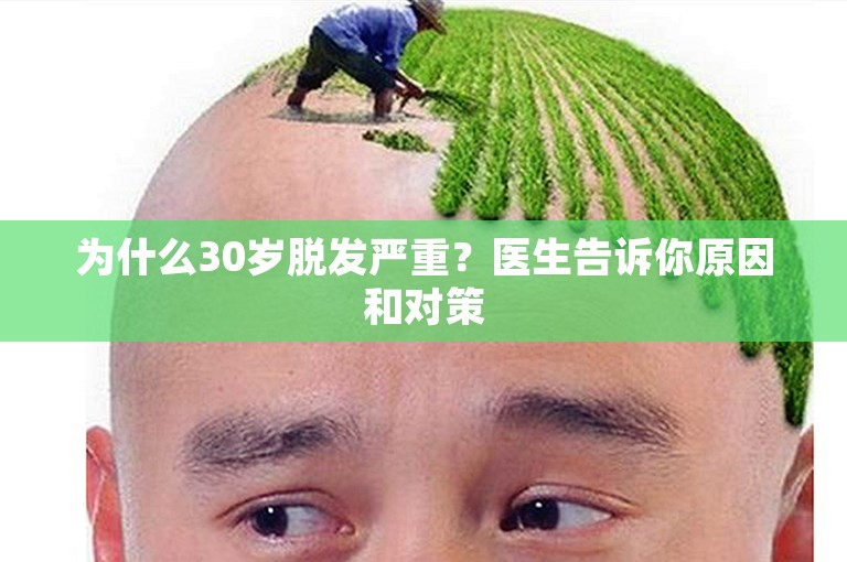 为什么30岁脱发严重？医生告诉你原因和对策