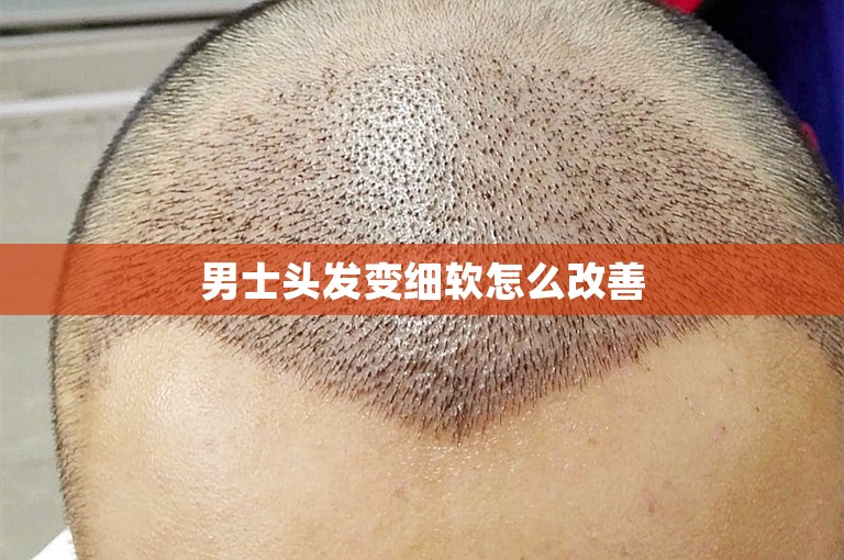 男士头发变细软怎么改善