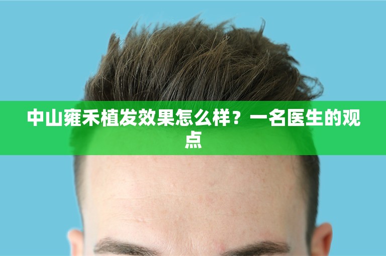 中山雍禾植发效果怎么样？一名医生的观点