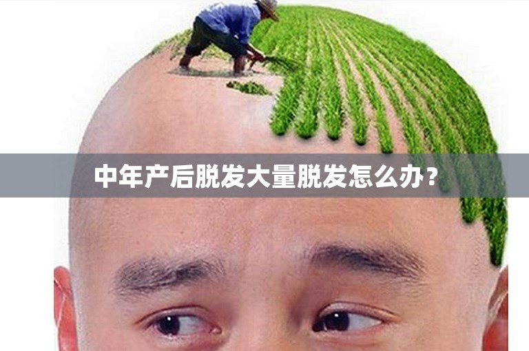 中年产后脱发大量脱发怎么办？