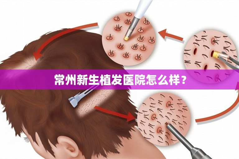 常州新生植发医院怎么样？