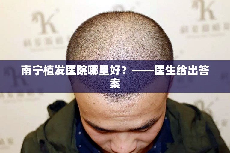 南宁植发医院哪里好？——医生给出答案